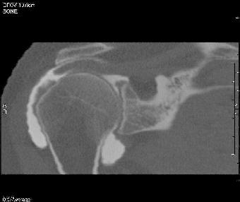 2/coronal